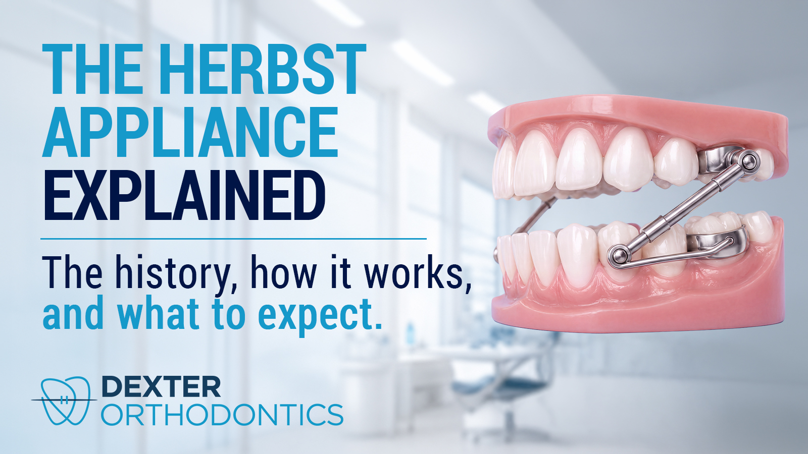 Close-up of an orthodontic teaching model showing a Herbst appliance mounted on the back teeth, illustrating how the fixed device gently guides jaw growth.