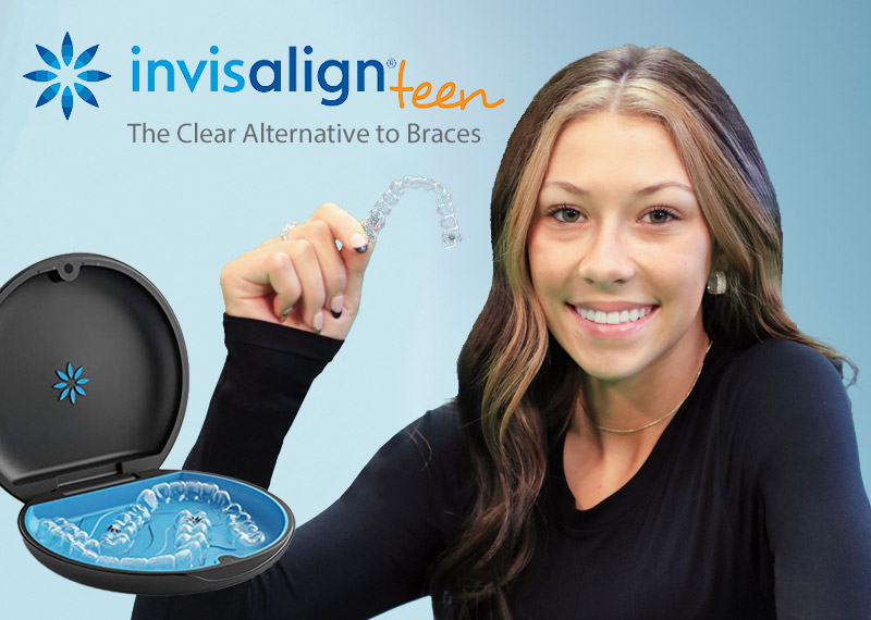 Invisalign: The Clear Alternative to Braces